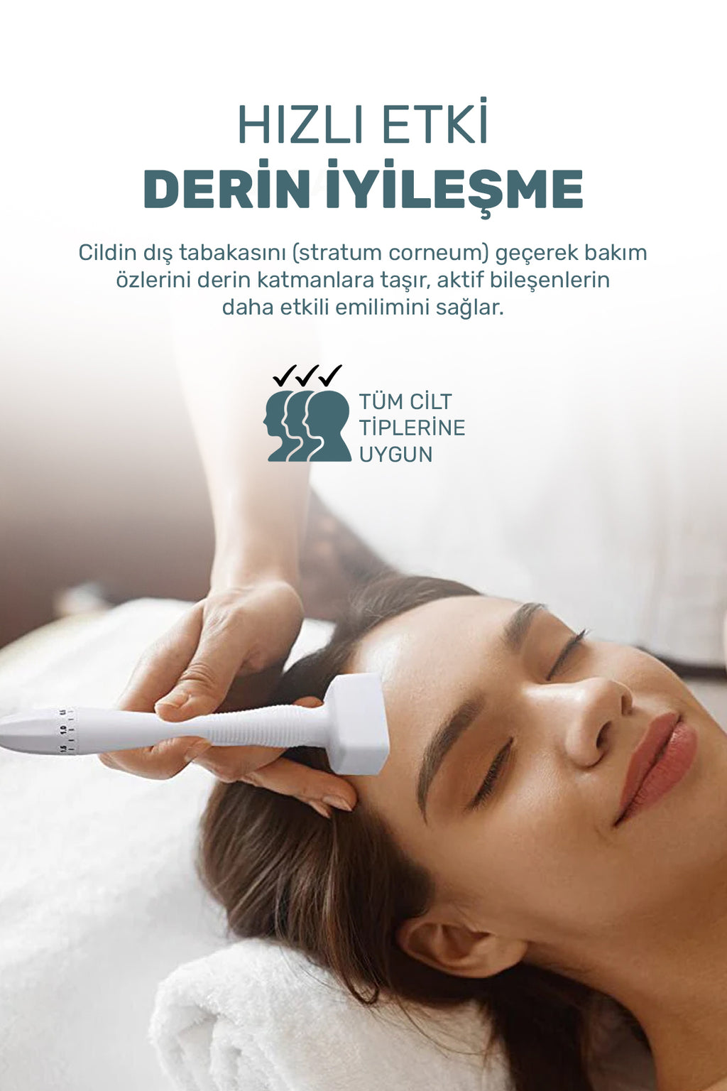 140 Titanyum İğneli Ayarlanabilir Dermastamp (0.25-3.0mm)