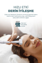 140 Titanyum İğneli Ayarlanabilir Dermastamp (0.25-3.0mm)